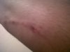 bite3.jpg